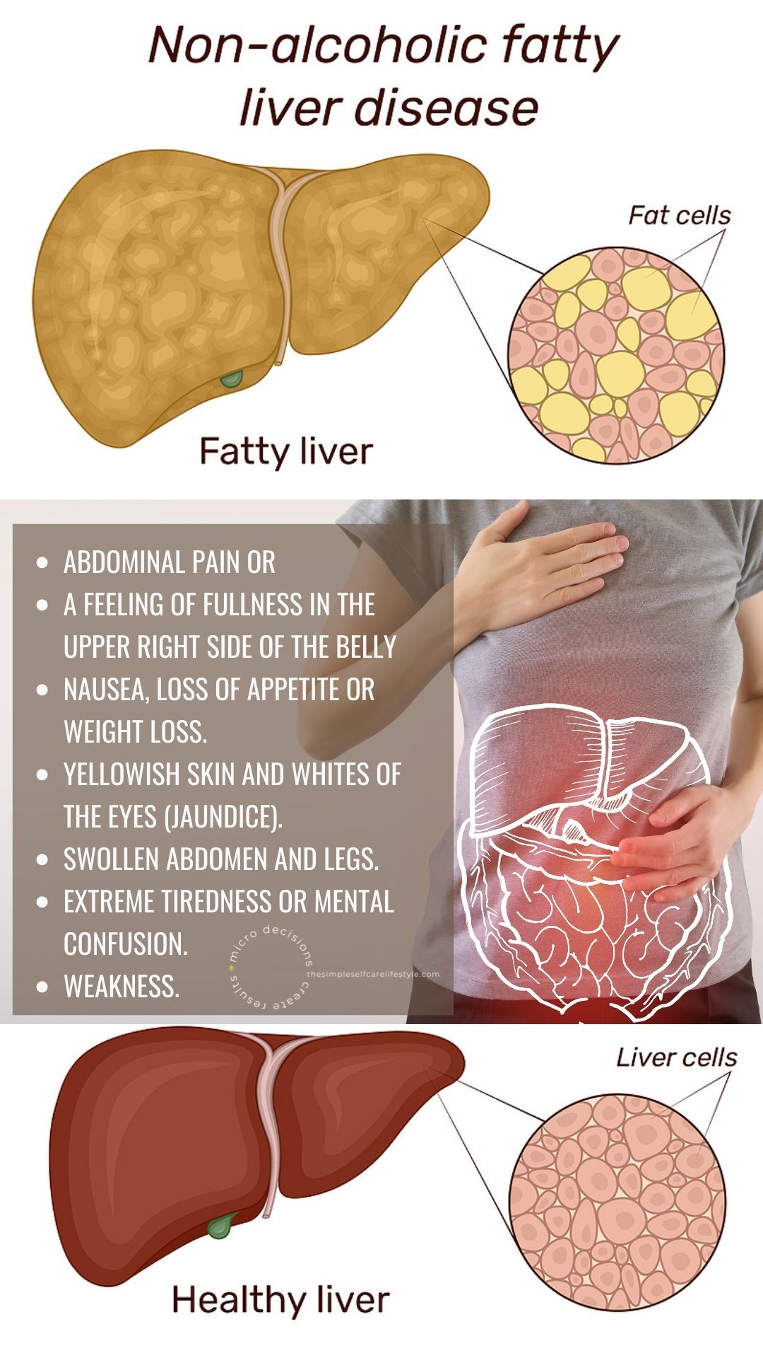 fatty liver causes Symptoms list