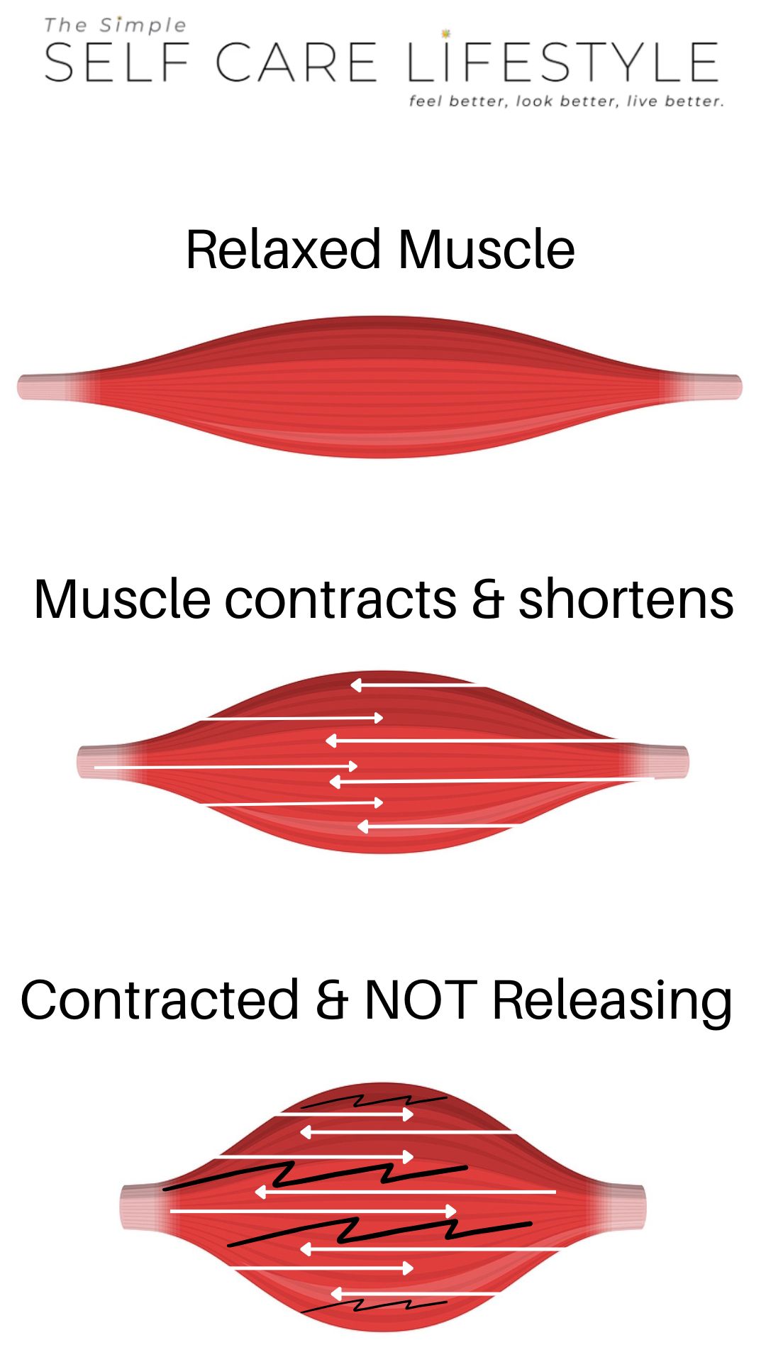 Relieving Muscle Cramps: 3 Muscle illustrations. 1. Relaxed, 2. contracting. 3rd cramping stuck in contracted position.