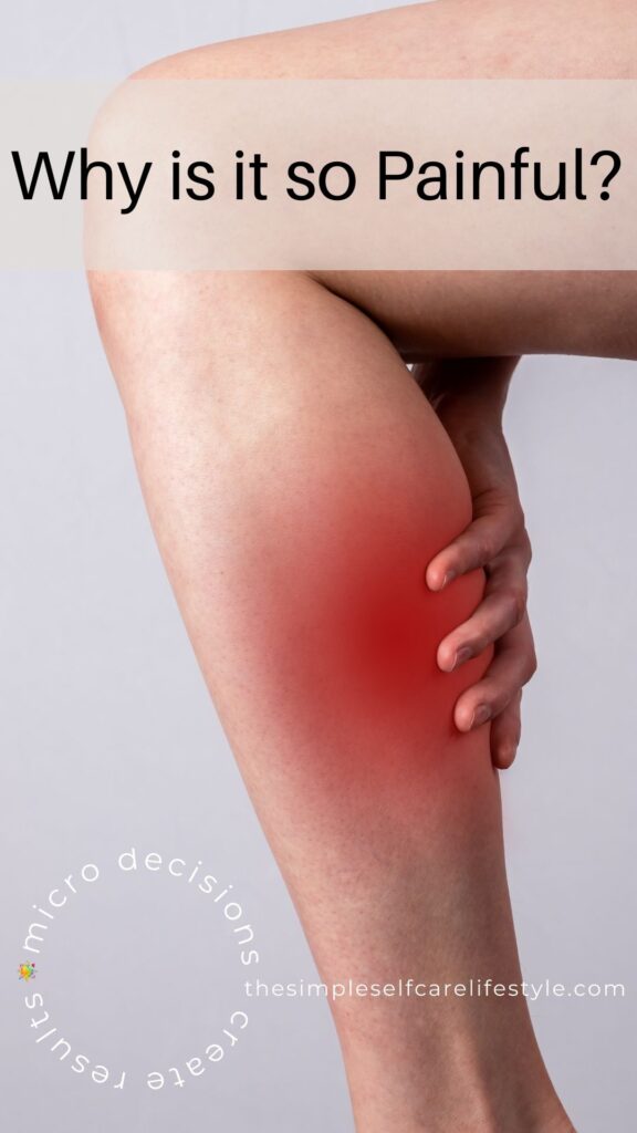 Relieving Leg Cramps. Woman pressing on calf muscle. The calf is highlighted in red to express it is cramped and painful.
